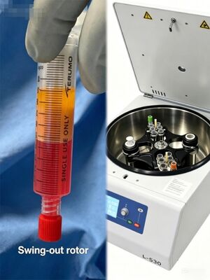 Calidad  YES PRP Kit 50/60ml Centrifuge 50ml  Syringe Fat Transfer LCD Display  4200 rpm Fábrica